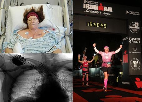 Heidi Dohse, a professional heart patient takes part in the Ironman marathon